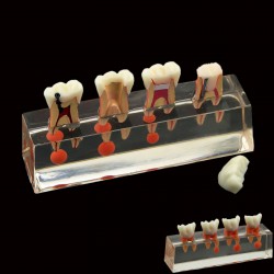 Dental Teeth Model 4-Stage Endodontic Treatment Demonstrates Anatomical M4018