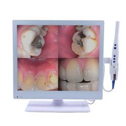 Dental 2-in-1 Wired Intraoral Camera with 17 Inch LED Monitor M-978 HDMI USB VGA