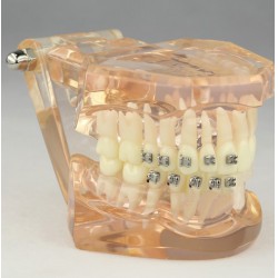 Dental Orthodontic Model with Ceramic Brackets M3009