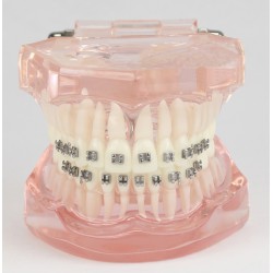 Dental Teeth Malocclusion Correct With Metal Bracket Standard Model M3001