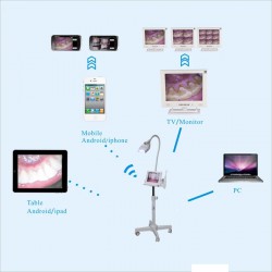 MLG® 8 inch LCD Monitor Teeth Whitening + Intraoral Camera M-86 Trolley-type With SD Card