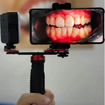 Adjustment Dental Photography Flash Light Mobile Phone Dental Photography Fill Light