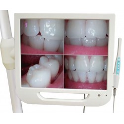 Dental Intraoral Camera 17 Inch High-Definition Digital LCD AIO Monitor