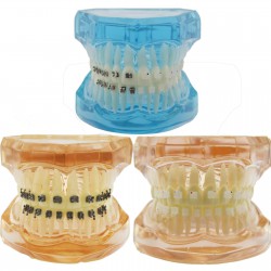 Dental Orthodontic Treatment Demonstration Practice Teeth Model