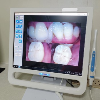 YF-1700P+ 17 Inch Dental Intraoral Camera Touch Screen for Dental Unit with Bracket 6PCS LEDS 8.0 Mega Pixels