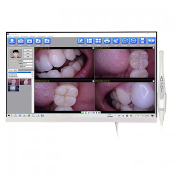 Magenta YF-2400P Dental Intraoral Camera with 24 Inch LCD Monitor & Wifi Function