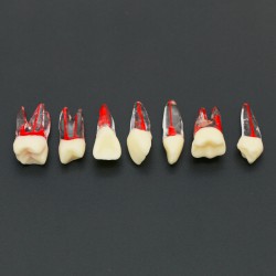 10Pcs Endodontic Root Canal RCT Practice Endo Teeth Model Pulp Study