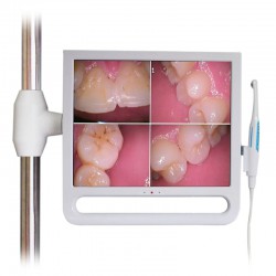 YF1700M 17 Inch Dental Intraoral Camera with LCD Monitor & Bracket 1024*768 Pixels