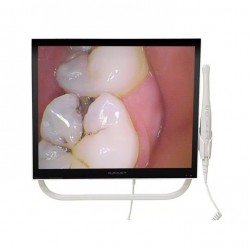 Magenta YFHD-D Dental Intraoral Camera 1/4 Sony CCD 17 Inch Monitor & Bracket