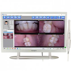 Magenta YF-2200P+ Touch Screen Intraoral Camera with 21.5 Inch LCD Monitor VGA+HDMI