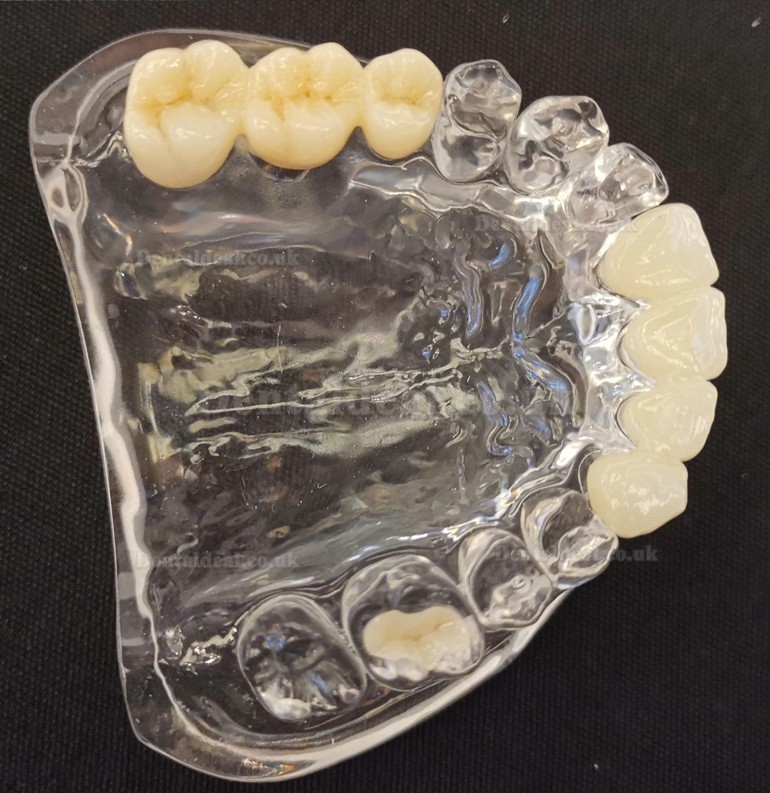 1Pcs 3D Dental Lab Multilayer Zirconia Block CAD/CAM Ceramic Block