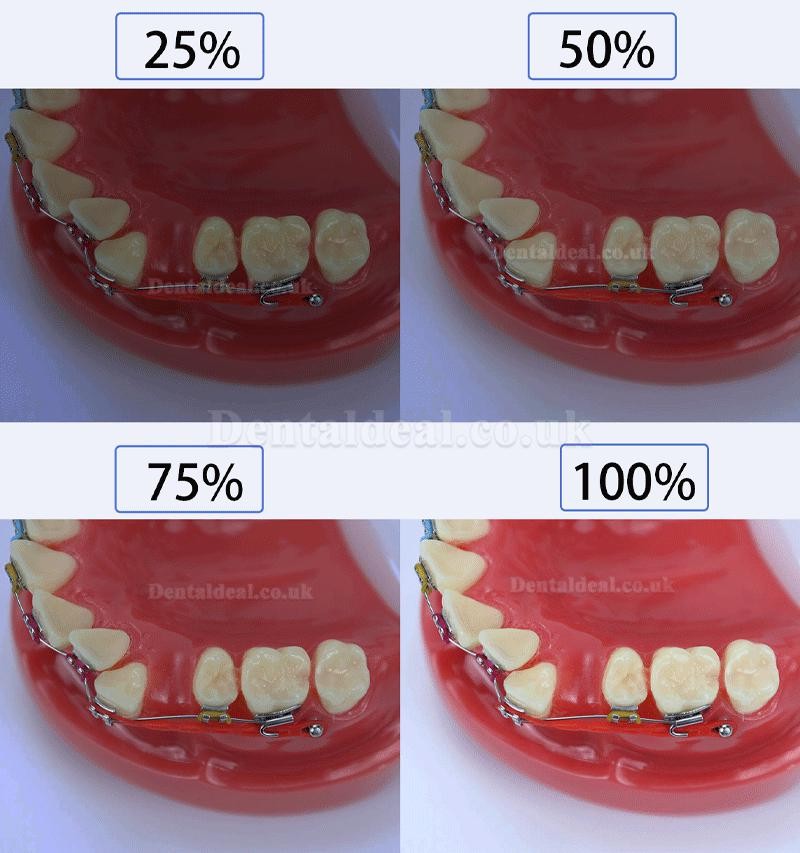 Adjustment Dental Photography Flash Light Mobile Phone Dental Photography Fill Light