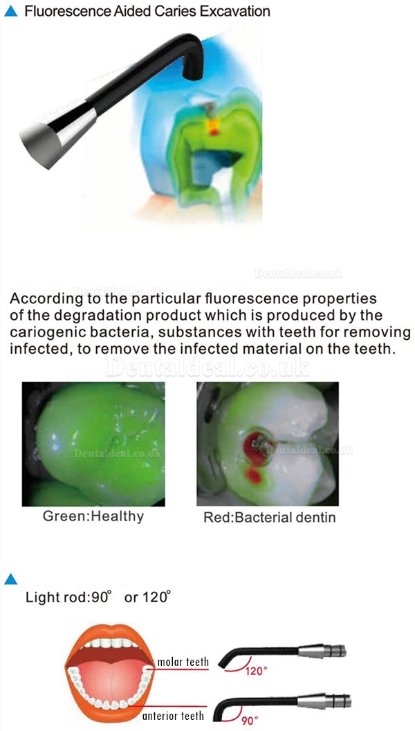 YUSENDENT®C-Hunter Dental Caries Detector