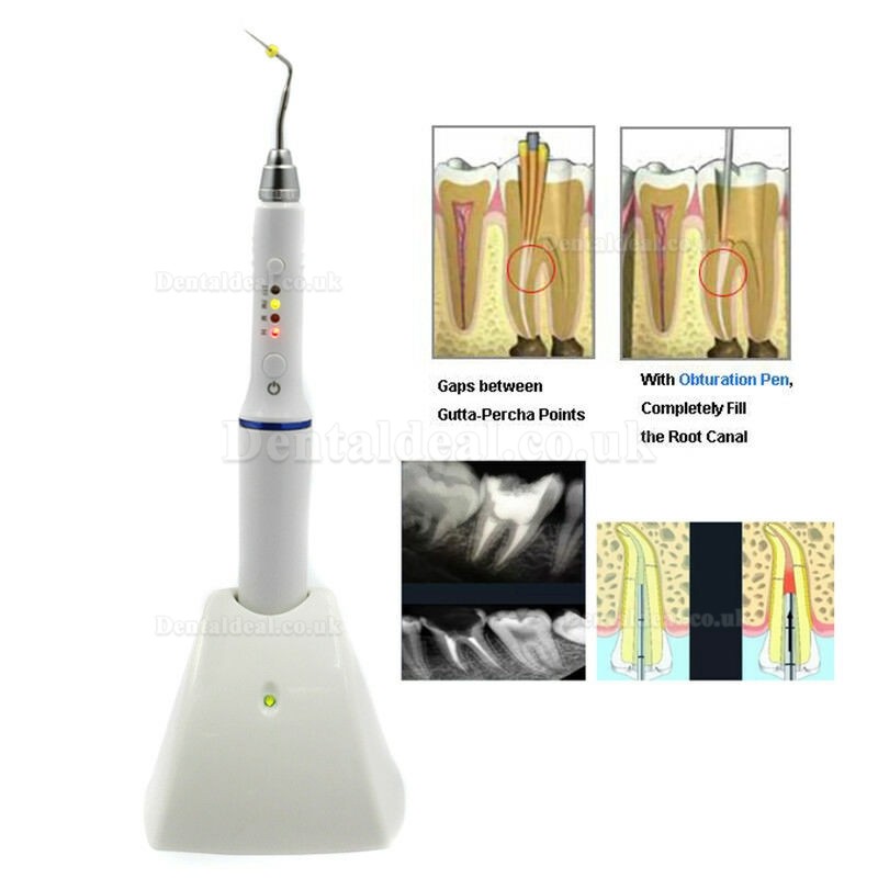 Dental Wireless Gutta Percha Obturation System Endo Heated Pen