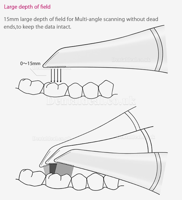 Fussen Dental 3D Digital Intraoral Scanner