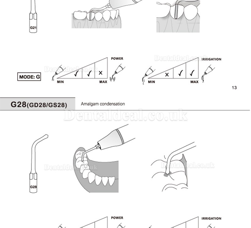 5 Pcs Dental Scaling Tips G20 G21 G30 G31 G32 G33 G35 Compatible with REFINE EMS Woodpecker Scaler Handpiece