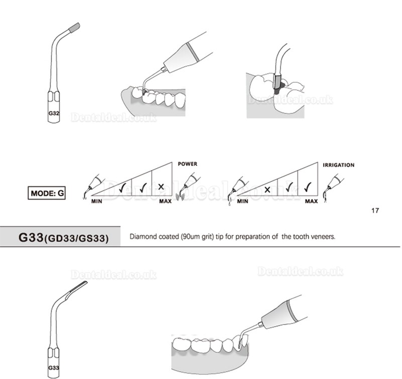 5 Pcs Dental Scaling Tips G20 G21 G30 G31 G32 G33 G35 Compatible with REFINE EMS Woodpecker Scaler Handpiece