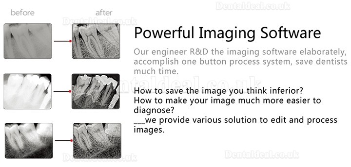 Handy HDR-600 Digital Dental X-Ray Imaging System X-Ray Sensor System