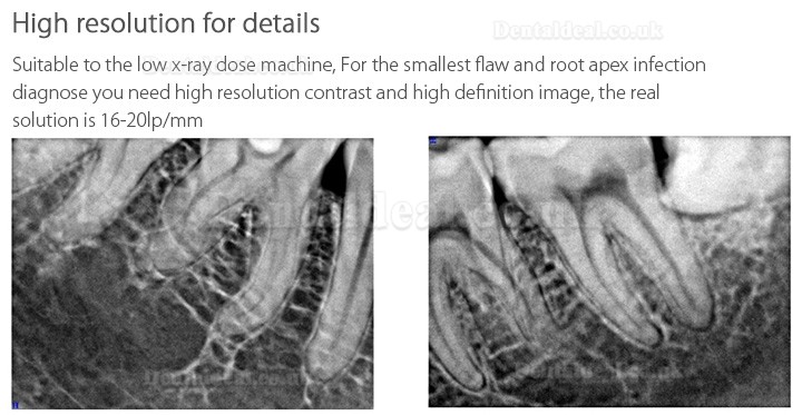 Handy HDR-600 Digital Dental X-Ray Imaging System X-Ray Sensor System