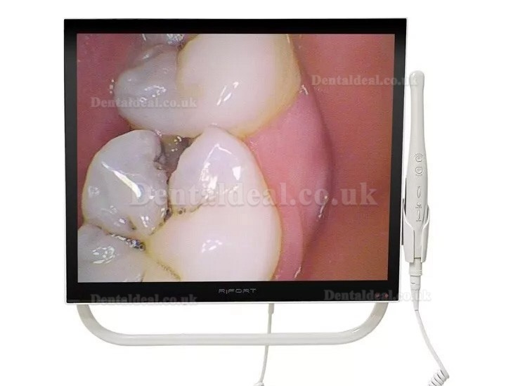 Magenta YFHD-D Dental Intraoral Camera 1/4 Sony CCD 17 Inch Monitor & Bracket