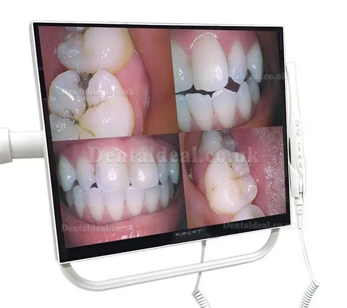 Magenta YFHD-D Dental Intraoral Camera 1/4 Sony CCD 17 Inch Monitor & Bracket