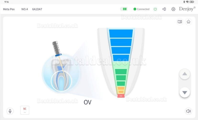 Denjoy MeteEndo Moible Dental Endo Integrated Cart System (with Meta Fill/Meta Pex/Meta Motor/Meta Pulp/Meta Pack)