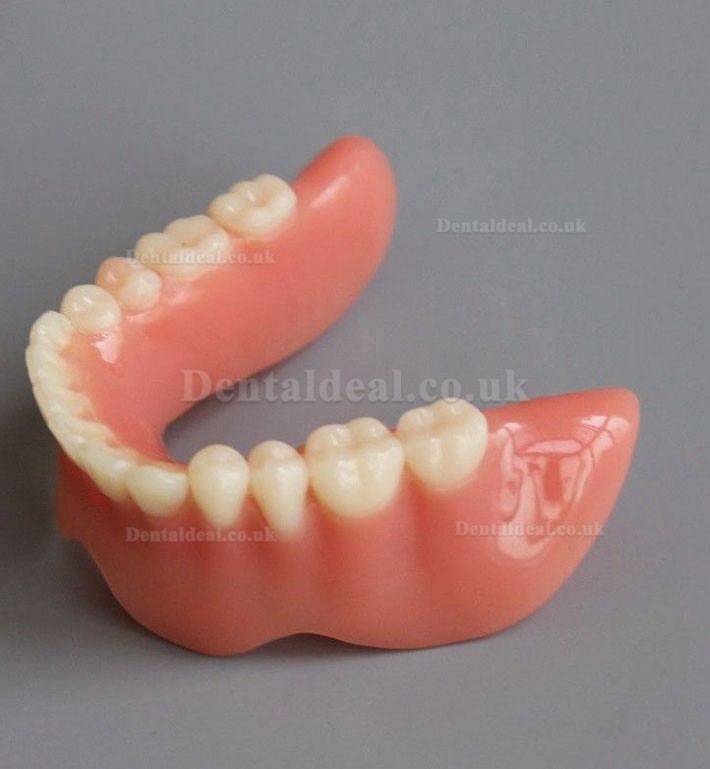 Dental Model #2014 02 - Mandible Implant and Overdenture Demo Model (Yellow)