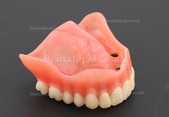 Dental Study Teeth Model Overdenture Superior With 4 Implants Demo Model 6001