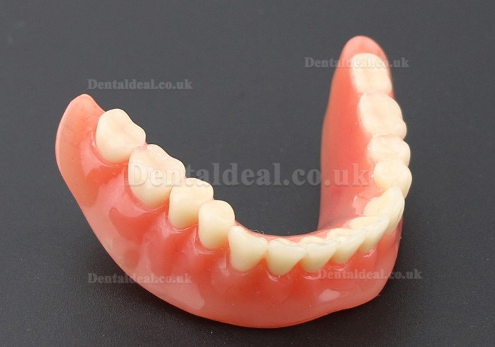 Dental Teeth Model Overdenture Inferior with 2 Implants Study Demo Model 6002 01