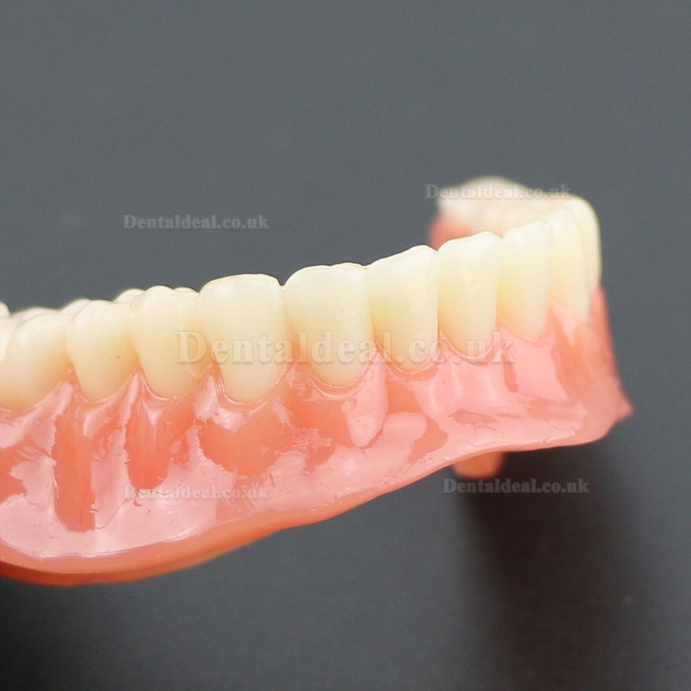 Dental Lower Teeth Demo Study Model 6002 02 Overdenture Inferior 4 Implants