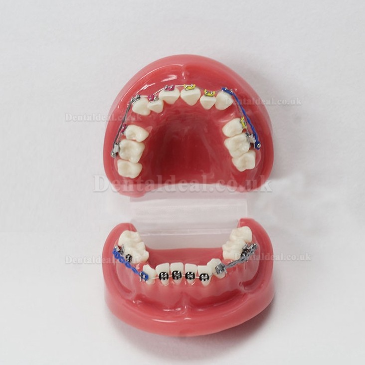 Dental Teeth Malocclusion Correct With Teeth Bracket Standard Model M3005