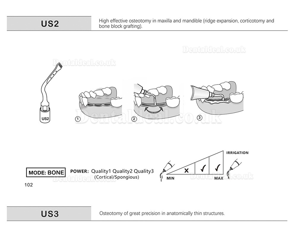 1Pcs Dental Piezosurgery Osteotomy Bone Cutting Dental Surgery Tips US1 US1L US1R US2 US3 US4 US5 US6 US7 US11Fit Mectro