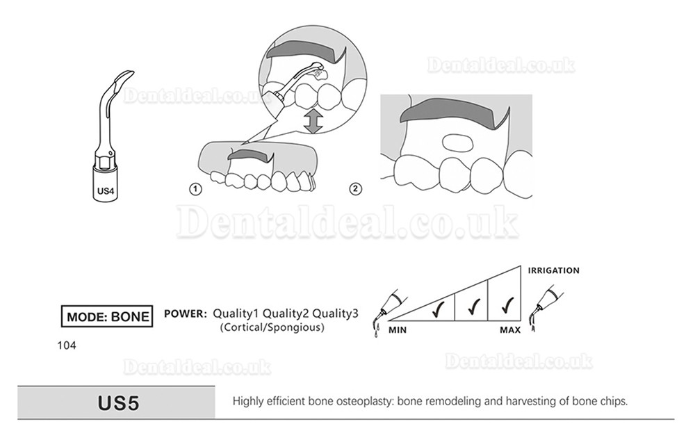 1Pcs Dental Piezosurgery Osteotomy Bone Cutting Dental Surgery Tips US1 US1L US1R US2 US3 US4 US5 US6 US7 US11Fit Mectro