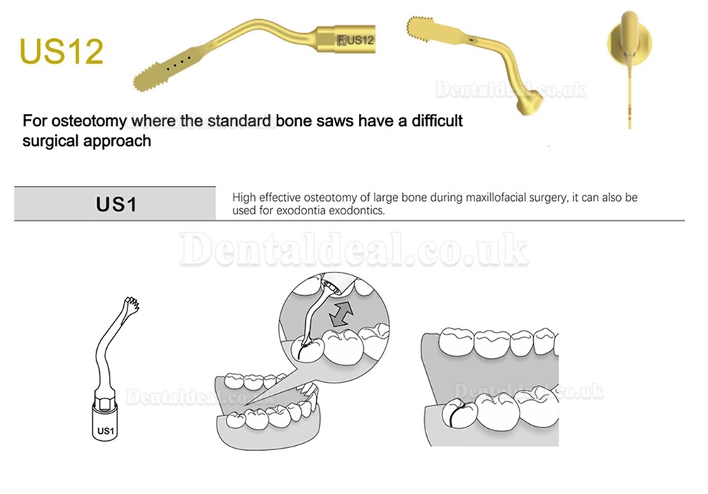 1Pcs Dental Piezosurgery Osteotomy Bone Cutting Dental Surgery Tips US1 US1L US1R US2 US3 US4 US5 US6 US7 US11Fit Mectro