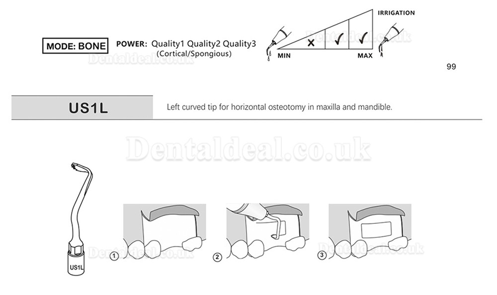 1Pcs Dental Piezosurgery Osteotomy Bone Cutting Dental Surgery Tips US1 US1L US1R US2 US3 US4 US5 US6 US7 US11Fit Mectro