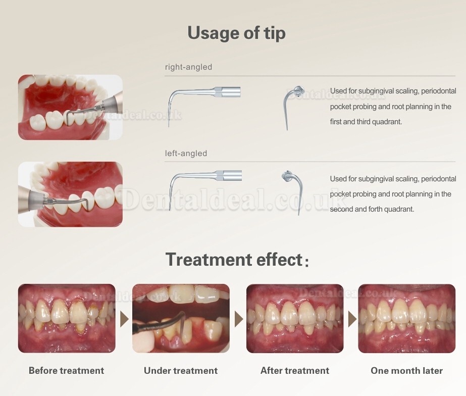 Woodpecker® PT Master 3 Dental Periodontal Treatment Device