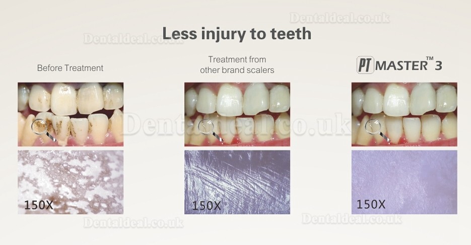 Woodpecker® PT Master 3 Dental Periodontal Treatment Device