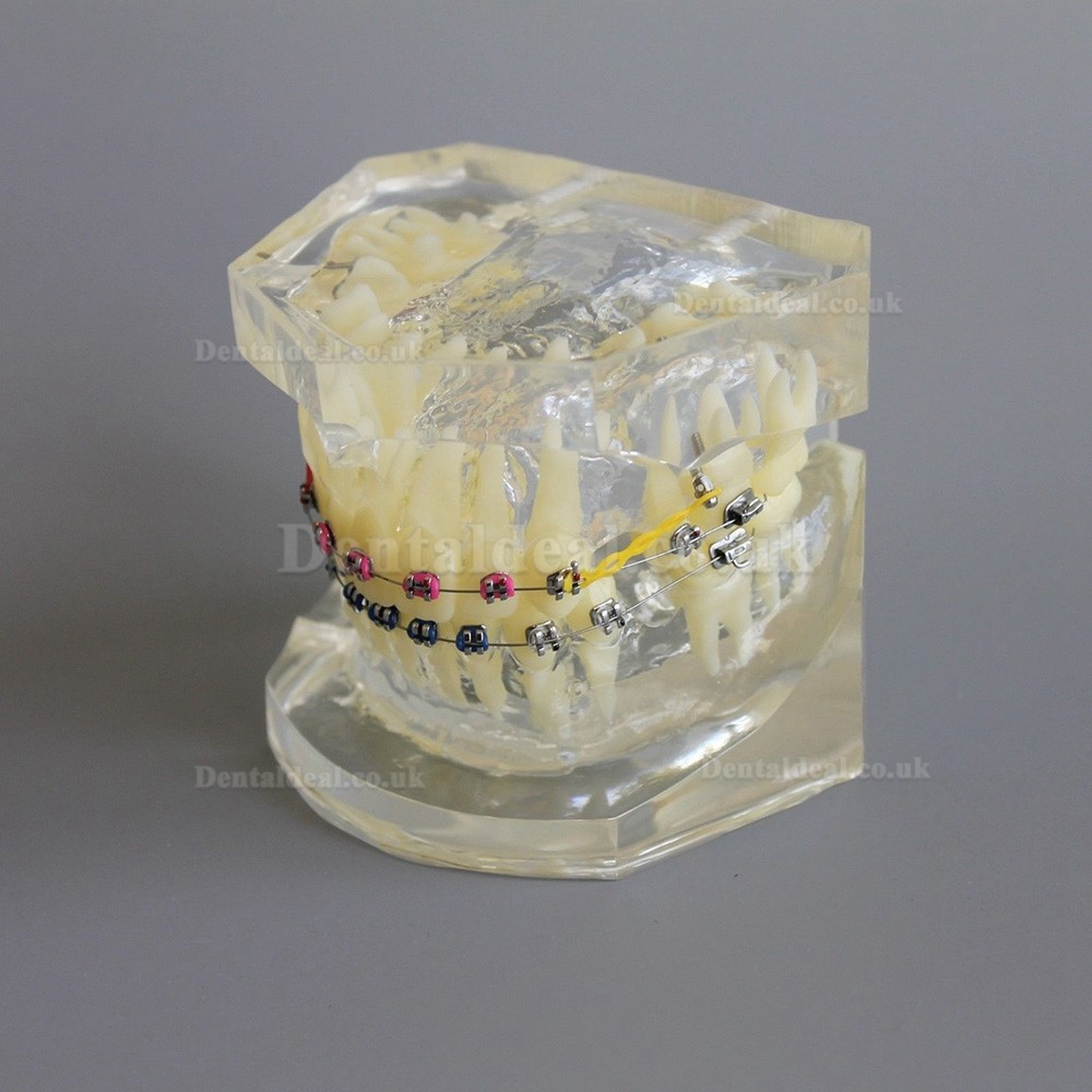 Dental Orthodontic Demonstration Practice Model With Metal Bracket Archwire