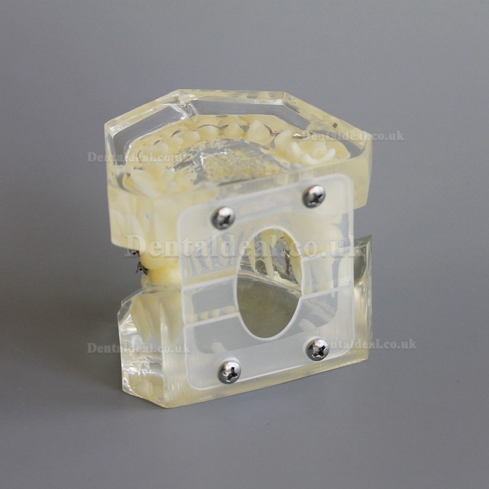 Dental Orthodontic Demonstration Practice Model With Metal Bracket Archwire