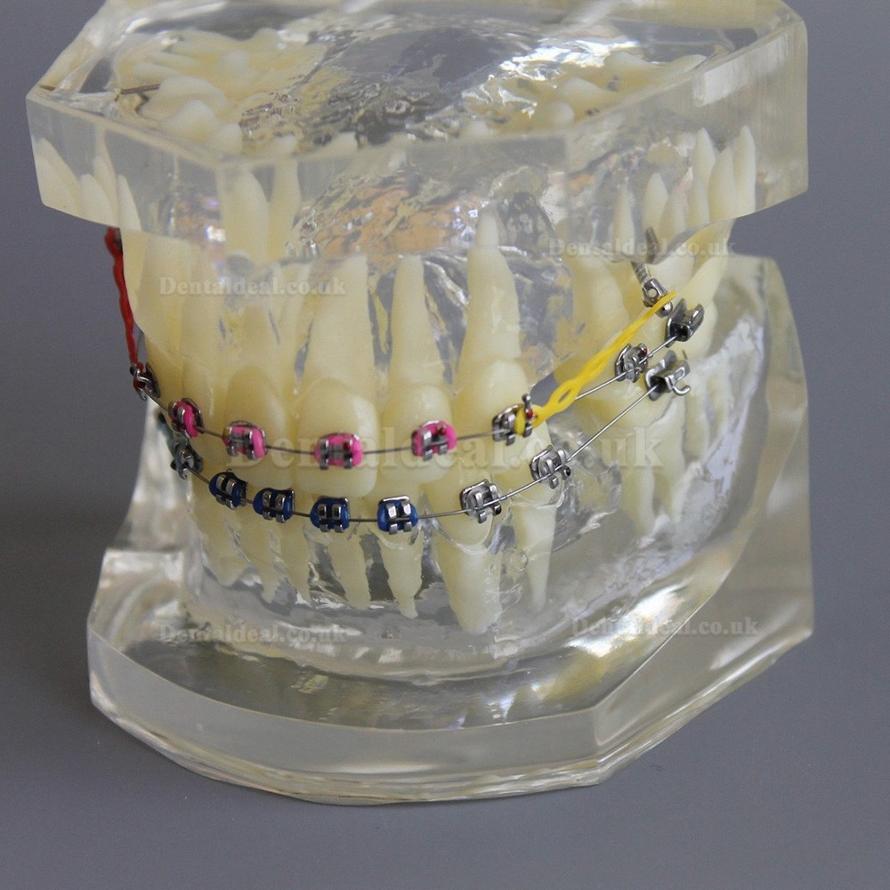 Dental Orthodontic Demonstration Practice Model With Metal Bracket Archwire