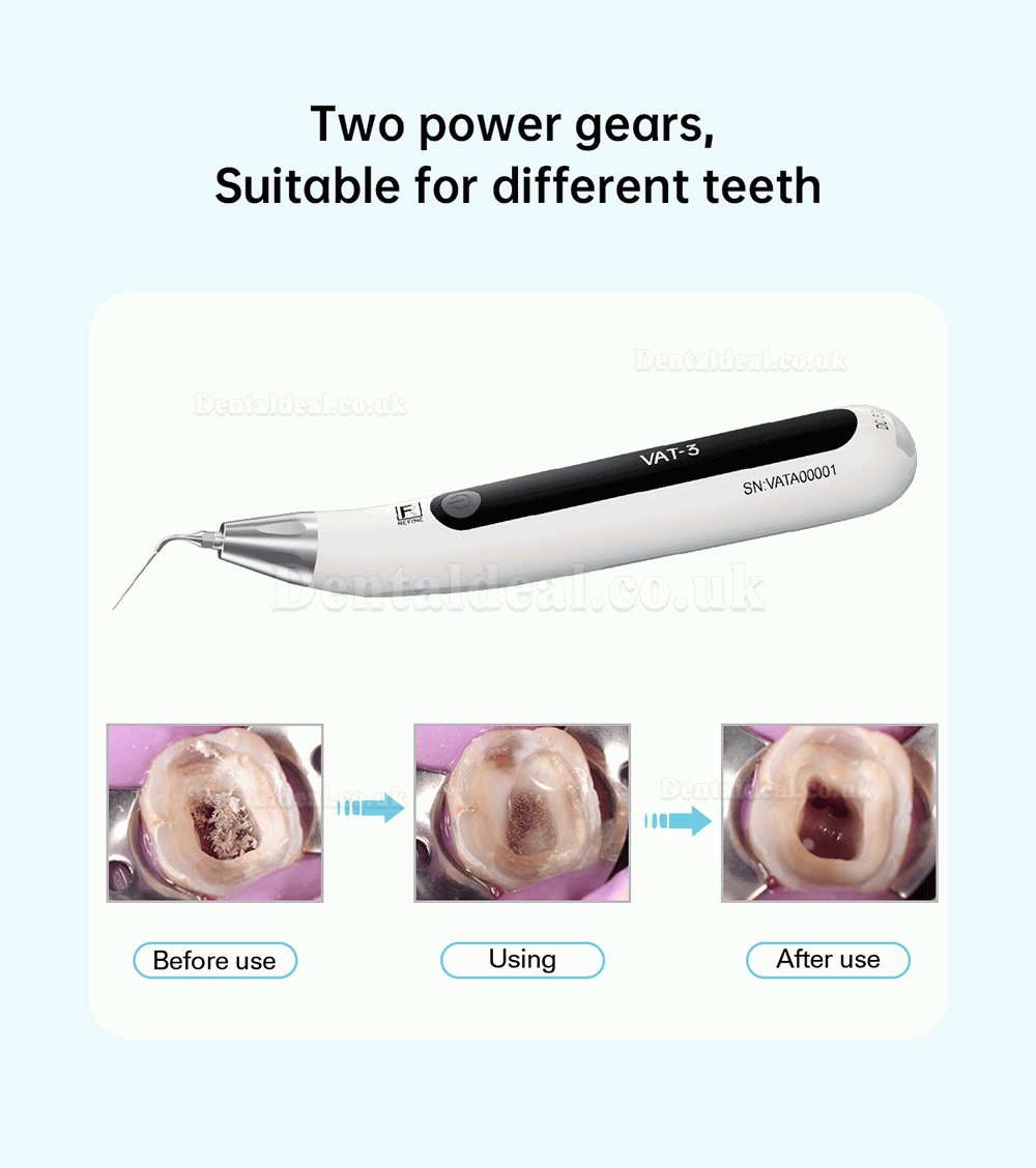 REFINE VAT-3 Endo Ultrasonic Activator Endoactivator Endodontic Irrigator Cordless