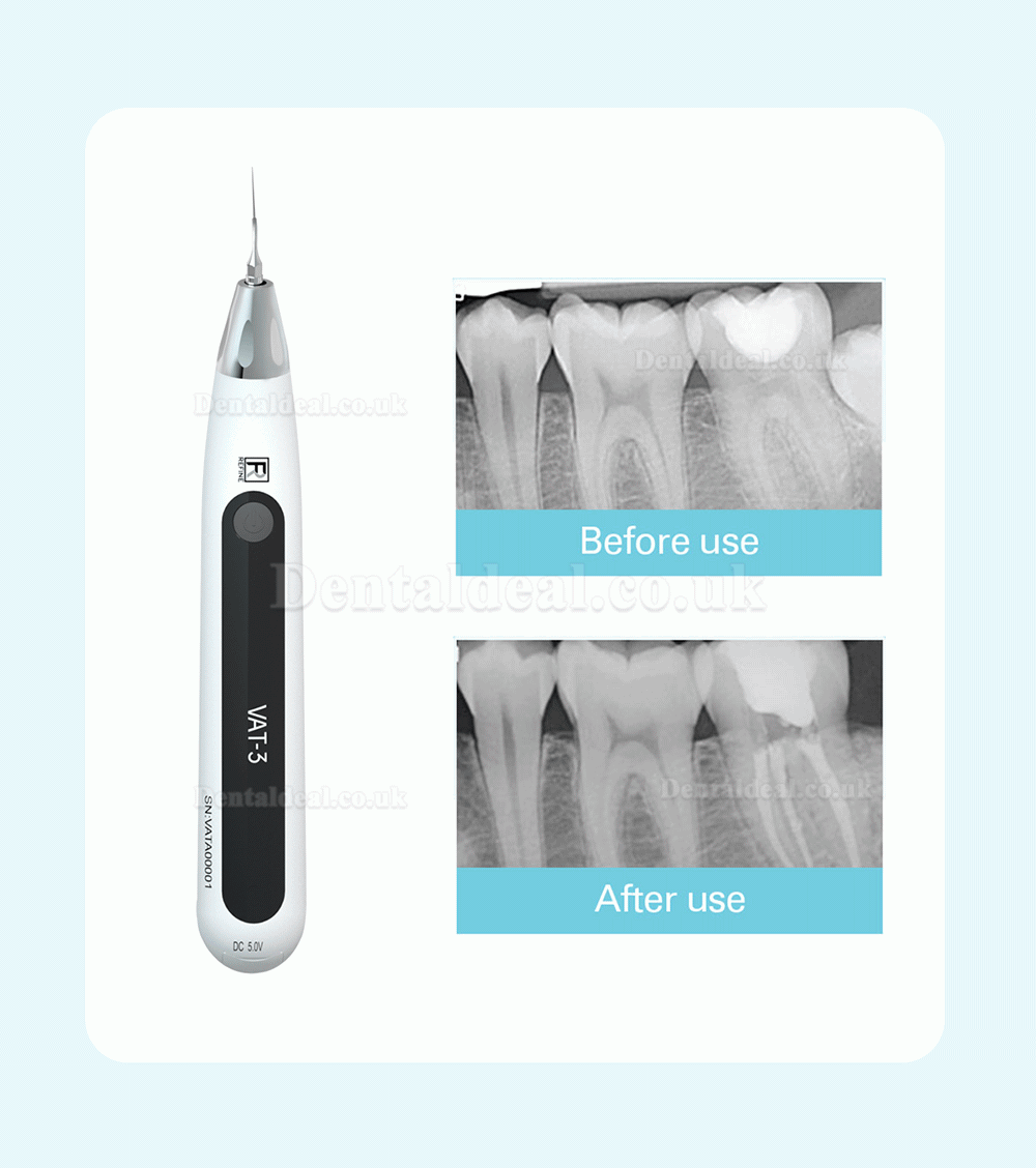 REFINE VAT-3 Endo Ultrasonic Activator Endoactivator Endodontic Irrigator Cordless