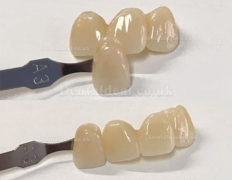 1PCS Aesthetic Restoration Zirconia Multilayer Dental Zircon Blocks Denture Material