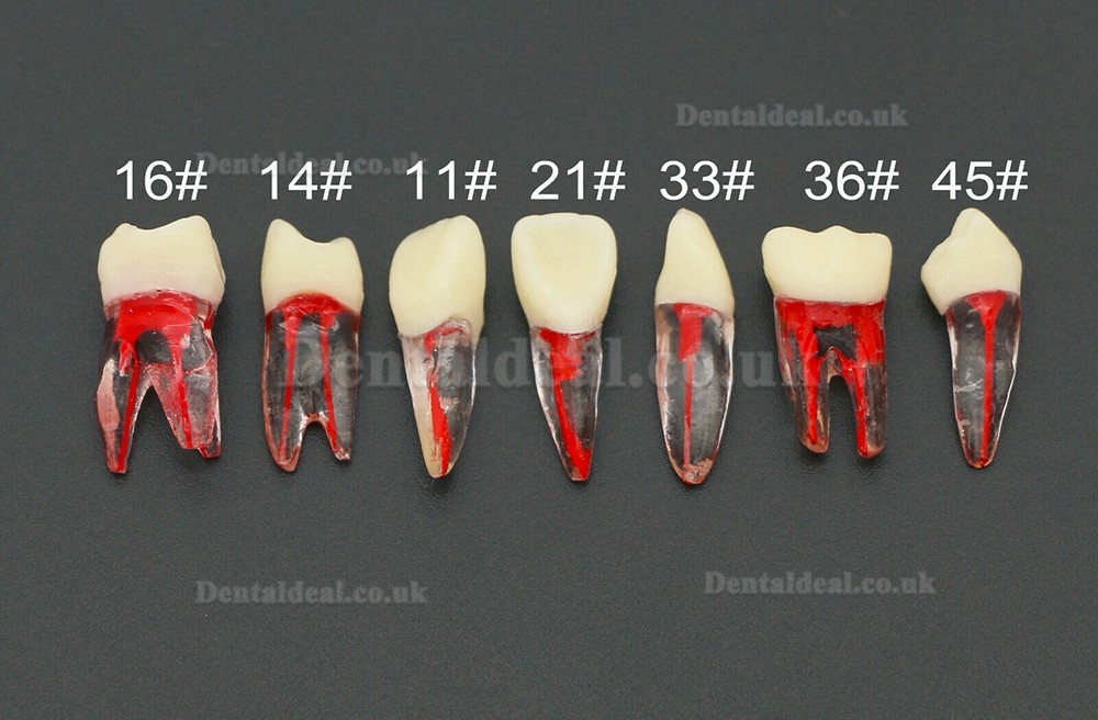 10Pcs  Endodontic Root Canal RCT Practice Endo Teeth Model Pulp Study