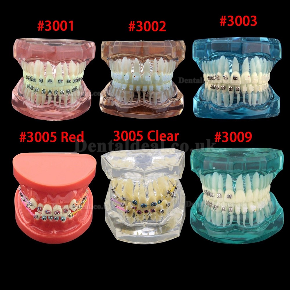 Dental Orthodontic Treatment Demonstration Practice Teeth Model