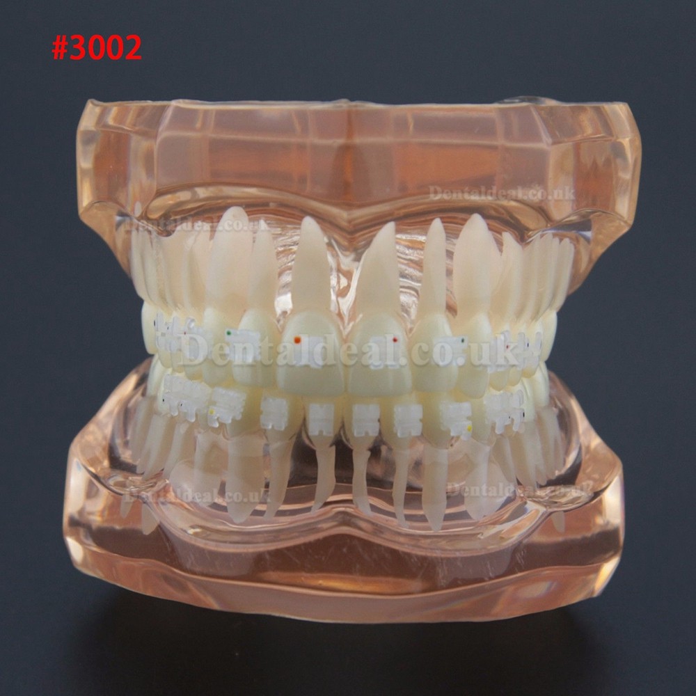 Dental Orthodontic Treatment Demonstration Practice Teeth Model