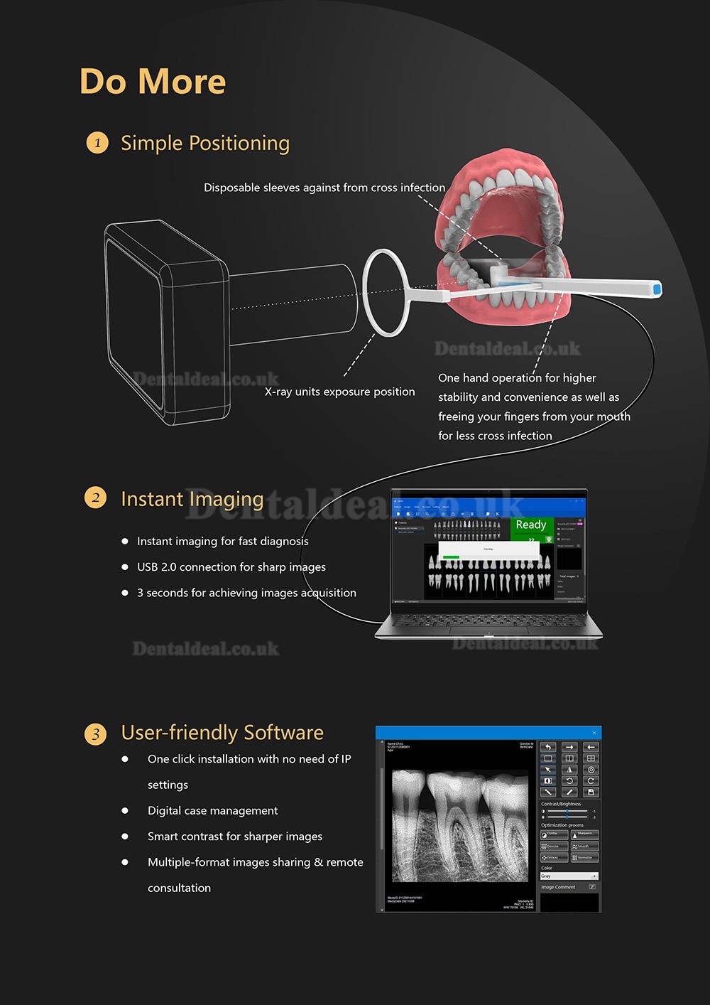 Dental Digital X-Ray Sensor RVG Dental Intraoral Imaging System