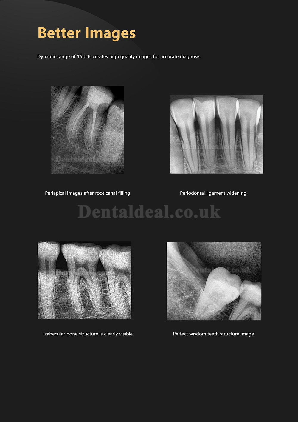 Dental Digital X-Ray Sensor RVG Dental Intraoral Imaging System