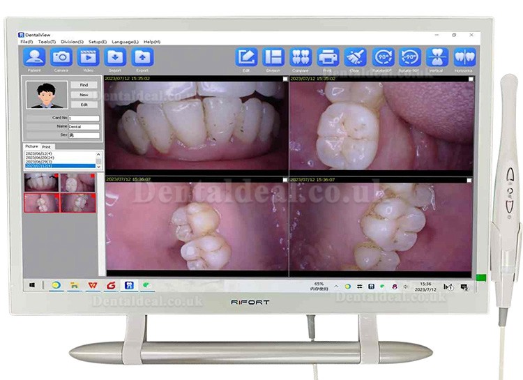 Magenta YF-2200P+ Touch Screen Intraoral Camera with 21.5 Inch LCD Monitor VGA+HDMI