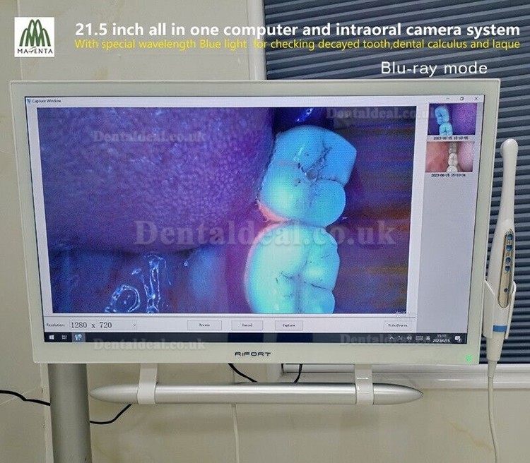 Magenta YF-2200P+ Touch Screen Intraoral Camera with 21.5 Inch LCD Monitor VGA+HDMI